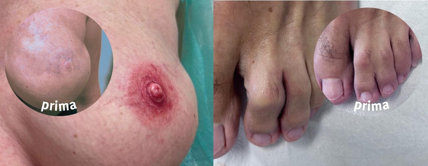 dermopigmentazione servizio di dermopigmentazione medicale